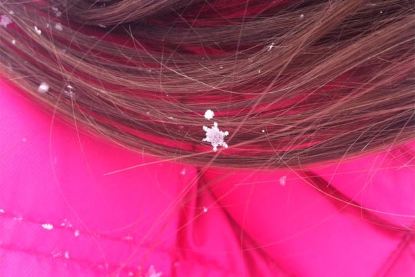 A perfect snowflake lands in a girl's hair in Arlington (photo courtesy Kimberly Suiters)
